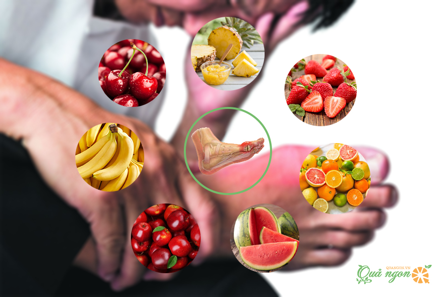 Top 7 loại trái cây tốt nhất cho người bị bệnh gout